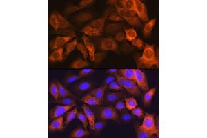 Immunofluorescence analysis of U-2 OS cells using F Rabbit mAb (ABIN7267150) at dilution of 1:100 (40x lens). (FABP1 antibody)