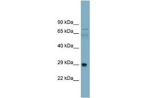 WB Suggested Anti-Alpha-DAG1 Antibody Titration:  0. (Dystroglycan antibody  (Middle Region))