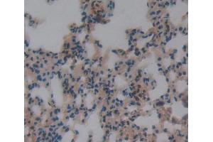 Used in DAB staining on fromalin fixed paraffin- embedded lung tissue (DOK3 antibody  (AA 160-409))