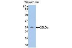 Western Blotting (WB) image for anti-Aminopeptidase Puromycin Sensitive (NPEPPS) (AA 584-793) antibody (ABIN1176245) (NPEPPS antibody  (AA 584-793))