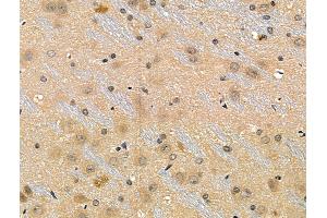 Phospho-53BP1 (Ser25/Ser29) Antibody at 1/100 staining Rat brain tissue by IHC-P.