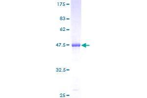 PLA2G4C Protein (AA 1-199) (GST tag)