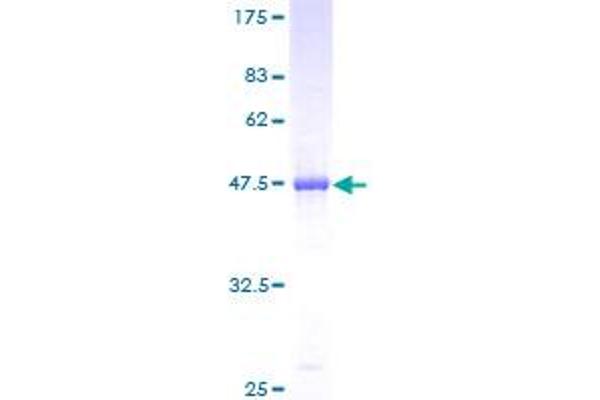 PLA2G4C Protein (AA 1-199) (GST tag)