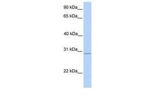 Image no. 1 for anti-UDP-N-Acetyl-alpha-D-Galactosamine:polypeptide N-Acetylgalactosaminyltransferase 10 (GalNAc-T10) (GALNT10) (AA 380-429) antibody (ABIN6738505) (GALNT10 antibody  (AA 380-429))