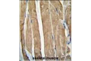 PG antibody (N-term) (ABIN654461 and ABIN2844194) immunohistochemistry analysis in formalin fixed and paraffin embedded human skeletal muscle followed by peroxidase conjugation of the secondary antibody and DAB staining. (PGAM2 antibody  (N-Term))
