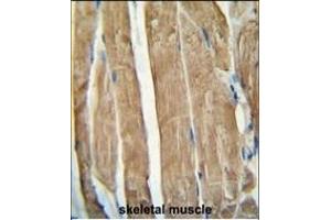 PG antibody (N-term) (ABIN654461 and ABIN2844194) immunohistochemistry analysis in formalin fixed and paraffin embedded human skeletal muscle followed by peroxidase conjugation of the secondary antibody and DAB staining. (PGAM2 antibody  (N-Term))