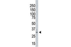 Western blot testing of AURKC antibody and A375 cell lysate. (Aurora Kinase C antibody  (C-Term))