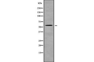Western blot analysis SLC22A17 using K562 whole cell lysates (SLC22A17 antibody  (C-Term))