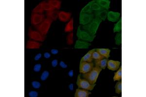 ABIN6258806 and ABIN6276239 staining Hela cells(45 min of heat-shock) by IF/ICC.