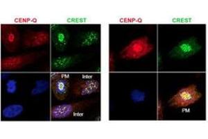 Image no. 2 for anti-Centromere Protein Q (CENPQ) antibody (ABIN1100754)