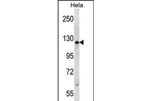 RP1 Antibody (N-term) (ABIN390353 and ABIN2840765) western blot analysis in Hela cell line lysates (35 μg/lane). (PARP1 antibody  (N-Term))
