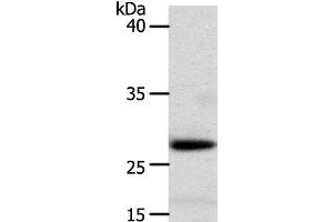 Western Blot analysis of Human liver cancer tissue using RARRES1 Polyclonal Antibody at dilution of 1:300 (RARRES1 antibody)