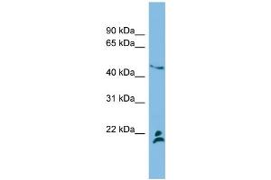 WB Suggested Anti-MGMT  Antibody Titration: 0. (MGMT antibody  (Middle Region))