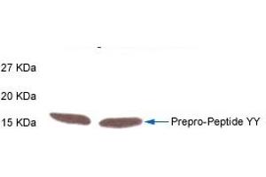 Western Blot Analysis of Prepro-Peptide YY in rat intestine tissue by Rabbit Anti-PYY(3-36)  (Human) Antibody. (Peptide YY antibody  (AA 3-36))