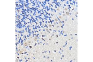 Immunohistochemistry of paraffin-embedded Mouse brain using hnRNP U Rabbit pAb (ABIN1680323, ABIN3018279, ABIN3018280 and ABIN6220424) at dilution of 1:50 (40x lens). (HNRNPU antibody  (AA 608-825))