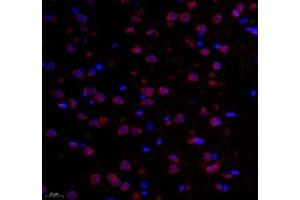 Immunofluorescence of paraffin embedded rat corpus striatum using GPR137A (ABIN7073996) at dilution of 1: 6500 (400x lens) (GPR137 antibody)
