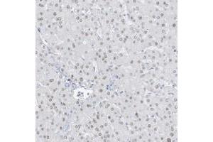 Immunohistochemical staining of human liver with ZFP64 polyclonal antibody  shows nuclear positivity in hepatocytes at 1:200-1:500 dilution. (ZFP64 antibody)