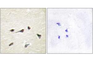 Immunohistochemistry analysis of paraffin-embedded human brain tissue, using AKAP12 Antibody. (AKAP12 antibody  (AA 301-350))