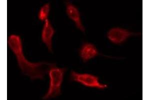 ABIN6276181 staining Hela by IF/ICC. (OR6P1 antibody  (Internal Region))