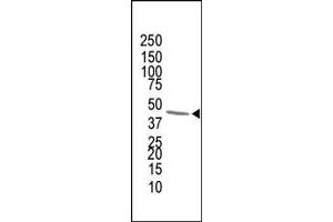 The anti-FDPS Pab (ABIN389054 and ABIN2839263) is used in Western blot to detect FDPS in human cytokeratin liver cell lysate. (FDPS antibody  (AA 389-419))