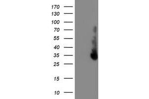 HEK293T cells were transfected with the pCMV6-ENTRY control (Left lane) or pCMV6-ENTRY ERCC1 (Right lane) cDNA for 48 hrs and lysed. (ERCC1 antibody)