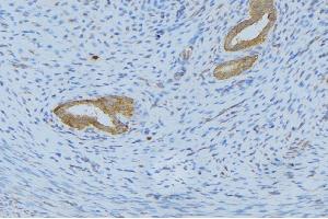 ABIN6268669 at 1/100 staining Human uterus tissue by IHC-P. (IL-5 antibody  (Internal Region))
