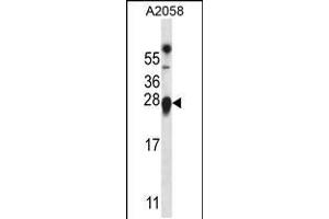 Western blot analysis in A2058 cell line lysates (35ug/lane). (TMED9 antibody  (C-Term))