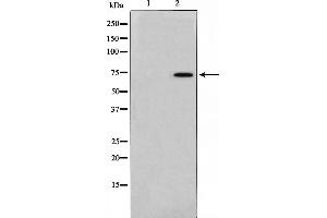 Western blot analysis on 293 cell lysate using TAF6L Antibody，The lane on the left is treated with the antigen-specific peptide. (TAF6L antibody  (N-Term))