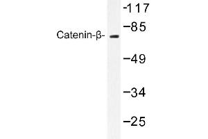 Image no. 1 for anti-Catenin (Cadherin-Associated Protein), beta 1, 88kDa (CTNNB1) antibody (ABIN272110) (CTNNB1 antibody)