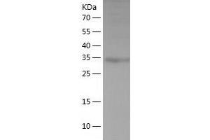 Western Blotting (WB) image for THAP Domain Containing 11 (THAP11) (AA 1-314) protein (His tag) (ABIN7288323) (THAP11 Protein (AA 1-314) (His tag))