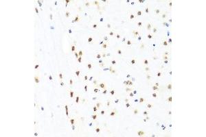 Immunohistochemistry of paraffin-embedded mouse brain using GATA2 antibody. (GATA2 antibody  (AA 1-300))