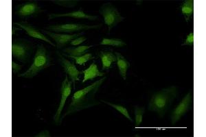 Immunofluorescence of purified MaxPab antibody to CDK6 on HeLa cell.
