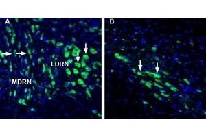 Expression of Lynx1 in rat dorsal raphe nucleus and substantia nigra pars compacta - Immunohistochemical staining of perfusion-fixed frozen rat brain sections with Anti-Lynx1 (extracellular) Antibody (ABIN7043310, ABIN7044635 and ABIN7044636), (1:1000), followed by goat anti-rabbit-AlexaFluor-488. (LYNX1 antibody  (Extracellular, N-Term))