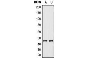 Western blot analysis of Cytokeratin 18 expression in MCF7 (A), Jurkat (B) whole cell lysates.