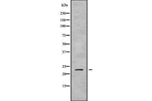 Western blot analysis of RAB43 using K562 whole cell lysates (RAB43 antibody  (Internal Region))