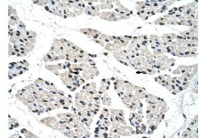 RALY antibody was used for immunohistochemistry at a concentration of 4-8 ug/ml to stain Skeletal muscle cells (arrows) in Human Muscle. (Raly antibody  (C-Term))