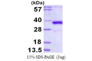 SDS-PAGE (SDS) image for Polymerase (DNA Directed), lambda (POLL) (AA 1-300) protein (His tag) (ABIN7279597) (POLL Protein (AA 1-300) (His tag))