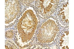 ABIN7095842 and ABIN7099904 at 1/100 staining rat testis tissue by IHC-P. (SLC44A3 antibody)