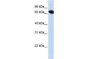 WB Suggested Anti-DLX4 Antibody Titration:  0. (DLX4 antibody  (Middle Region))