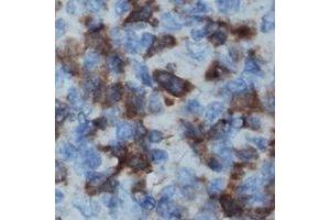 Immunohistochemical analysis of IL-16 staining in human lymph node formalin fixed paraffin embedded tissue section.