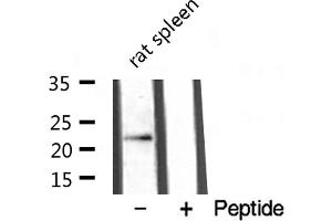 Western blot analysis of extracts from rat spleen , using TNFC antibody.