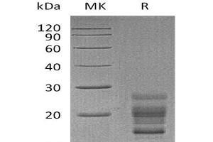 Western Blotting (WB) image for Interleukin 17A (IL17A) (Active) protein (His tag) (ABIN7320557) (Interleukin 17a Protein (His tag))