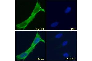 ABIN1589992 Immunofluorescence analysis of paraformaldehyde fixed HeLa cells, permeabilized with 0.