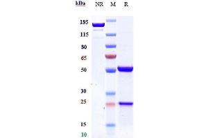 Anti-DLL3 Reference Antibody (rovalpituzumab) on SDS-PAGE under reducing (R) condition. (Recombinant DLL3 (Rovalpituzumab Biosimilar) antibody)