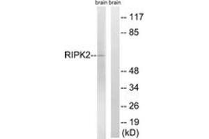 Western blot analysis of extracts from rat brain cells, using RIPK2 (Ab-176) Antibody.