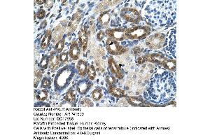 Immunohistochemistry (IHC) image for anti-Pyruvate Kinase, Liver and RBC (PKLR) (N-Term) antibody (ABIN2776945) (PKLR antibody  (N-Term))
