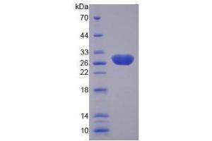 SDS-PAGE analysis of Human Laminin alpha 4 Protein.