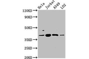Western Blot Positive WB detected in: Hela whole cell lysate, Jurkat whole cell lysate, A549 whole cell lysate, LO2 whole cell lysate All lanes: SHARPIN antibody at 5.