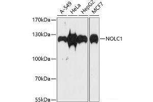Western blot analysis of extracts of various cell lines using NOLC1 Polyclonal Antibody at dilution of 1:1000. (NOLC1 antibody)