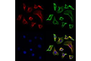 ABIN6261678 and ABIN6268891 staining Hela cells by IF/ICC at 1:100(red). (FAP antibody  (Internal Region))